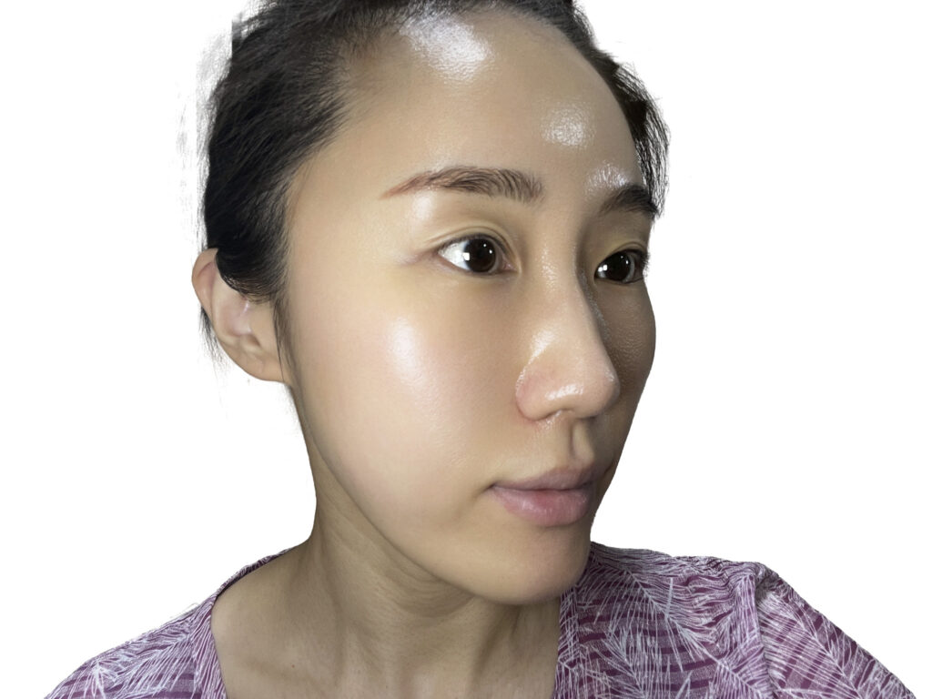 Close-up of luminous, hydrated skin finish from Theraderm sunscreen on forehead and cheeks