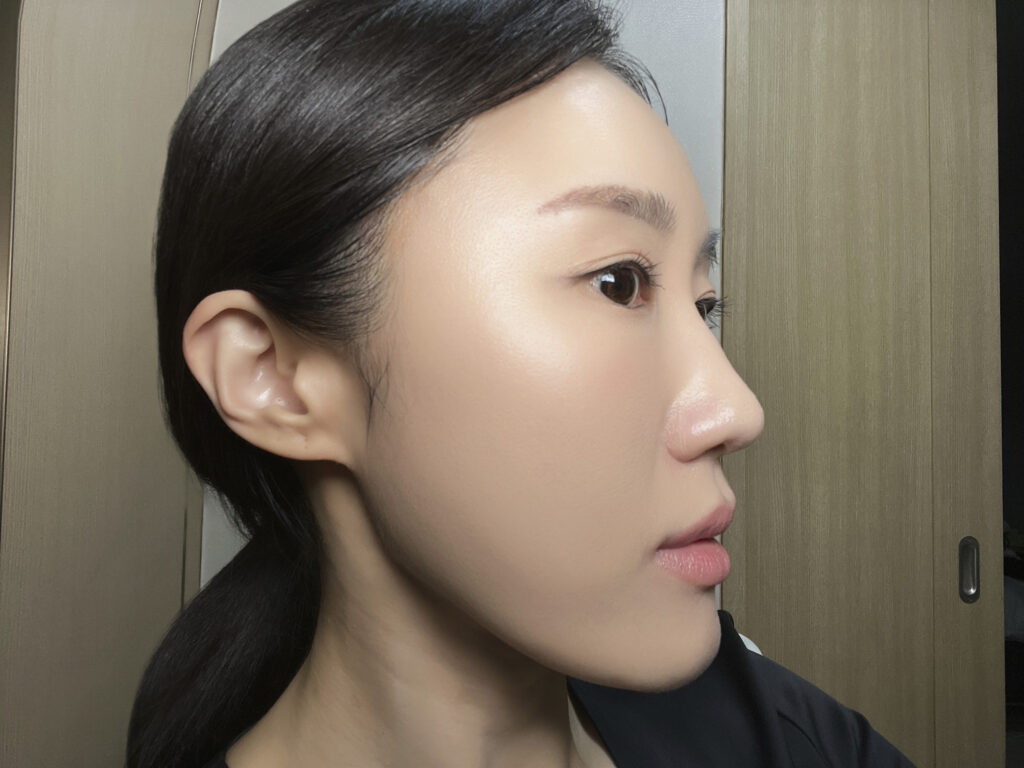 Another angle after coming home — still even, no visible patchiness or oxidation.